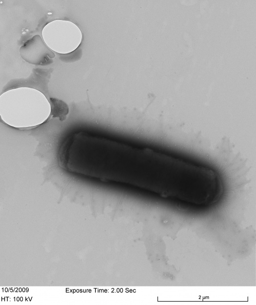 E.coli negatively stained with Ammonium Molybdate and analyzed by EM ...